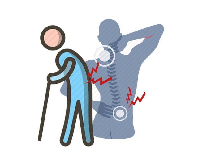 这样的腰痛，真有可能是癌症的征兆？医生提醒：还得结合这几点